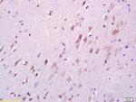 DARPP32 Antibody in Immunohistochemistry (Paraffin) (IHC (P))