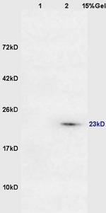 DARPP32 Antibody in Western Blot (WB)