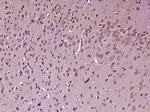 FOXO1 + FOXO4 Antibody in Immunohistochemistry (Paraffin) (IHC (P))