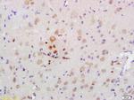 AMPK alpha 2 Antibody in Immunohistochemistry (Paraffin) (IHC (P))