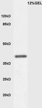 KLF2 Antibody in Western Blot (WB)