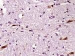 LIMK1 Antibody in Immunohistochemistry (Paraffin) (IHC (P))