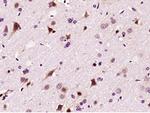 LIMK1 Antibody in Immunohistochemistry (Paraffin) (IHC (P))