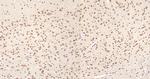 LIMK1 Antibody in Immunohistochemistry (Paraffin) (IHC (P))