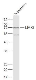 LIMK1 Antibody in Western Blot (WB)