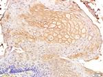 CD44v7 Antibody in Immunohistochemistry (Paraffin) (IHC (P))