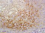 CD44RC Antibody in Immunohistochemistry (Paraffin) (IHC (P))