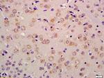 RET Antibody in Immunohistochemistry (Paraffin) (IHC (P))