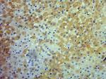 RET Antibody in Immunohistochemistry (Paraffin) (IHC (P))