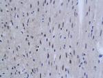 TNFAIP3 Antibody in Immunohistochemistry (Paraffin) (IHC (P))