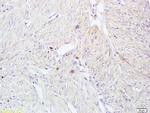 CD161 Antibody in Immunohistochemistry (Paraffin) (IHC (P))