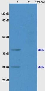 CD161 Antibody in Western Blot (WB)