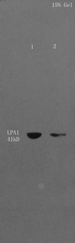 LPAR1 Antibody in Western Blot (WB)