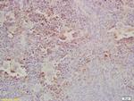 Gab2 Antibody in Immunohistochemistry (Paraffin) (IHC (P))
