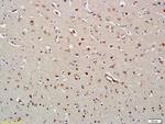 HDAC8 Antibody in Immunohistochemistry (Paraffin) (IHC (P))
