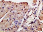 HDAC8 Antibody in Immunohistochemistry (Paraffin) (IHC (P))