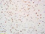 HDAC10 Antibody in Immunohistochemistry (Paraffin) (IHC (P))