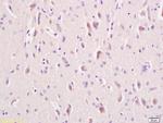 LRP5/LRP6 Antibody in Immunohistochemistry (Paraffin) (IHC (P))