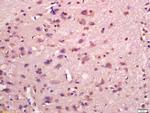 MAPKAP Kinase 2 Antibody in Immunohistochemistry (Paraffin) (IHC (P))
