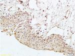 PARD-3 Antibody in Immunohistochemistry (Paraffin) (IHC (P))
