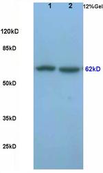Frizzled 5/8 Antibody in Western Blot (WB)