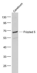 Frizzled 5/8 Antibody in Western Blot (WB)