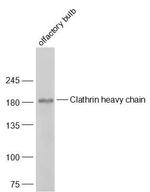 Clathrin heavy chain Antibody in Western Blot (WB)