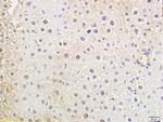TdT Antibody in Immunohistochemistry (Paraffin) (IHC (P))