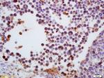 TdT Antibody in Immunohistochemistry (Paraffin) (IHC (P))