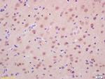 RASSF2 Antibody in Immunohistochemistry (Paraffin) (IHC (P))