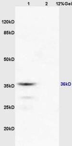 RASSF2 Antibody in Western Blot (WB)