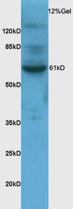 SNX1 Antibody in Western Blot (WB)