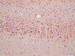 SQSTM1 Antibody in Immunohistochemistry (Paraffin) (IHC (P))