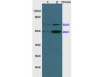SQSTM1 Antibody in Western Blot (WB)