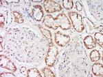 Alpha-ENaC Antibody in Immunohistochemistry (Paraffin) (IHC (P))