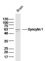 Syncytin 1 Antibody in Western Blot (WB)