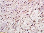 HPV33 E7 Antibody in Immunohistochemistry (Paraffin) (IHC (P))