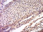 Noggin Antibody in Immunohistochemistry (Paraffin) (IHC (P))