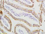 ADM2 Antibody in Immunohistochemistry (Paraffin) (IHC (P))