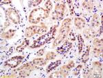 Mitofusin 2 Antibody in Immunohistochemistry (Paraffin) (IHC (P))