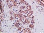 Mitofusin 2 Antibody in Immunohistochemistry (Paraffin) (IHC (P))