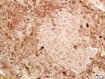 CITED1 Antibody in Immunohistochemistry (Paraffin) (IHC (P))