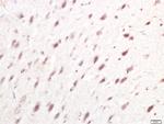 IRF7 Antibody in Immunohistochemistry (Paraffin) (IHC (P))