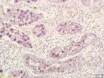 BMI1 Antibody in Immunohistochemistry (Paraffin) (IHC (P))