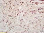 BMI1 Antibody in Immunohistochemistry (Paraffin) (IHC (P))