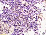 BMI1 Antibody in Immunohistochemistry (Paraffin) (IHC (P))