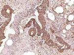 Phospho-arfaptin 2 (Ser260) Antibody in Immunohistochemistry (Paraffin) (IHC (P))