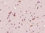 Phospho-ASK1 (Ser966) Antibody in Immunohistochemistry (Paraffin) (IHC (P))