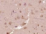 Phospho-BAD (Ser75) Antibody in Immunohistochemistry (Paraffin) (IHC (P))