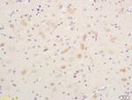 Phospho-B-Raf (Ser365) Antibody in Immunohistochemistry (Paraffin) (IHC (P))